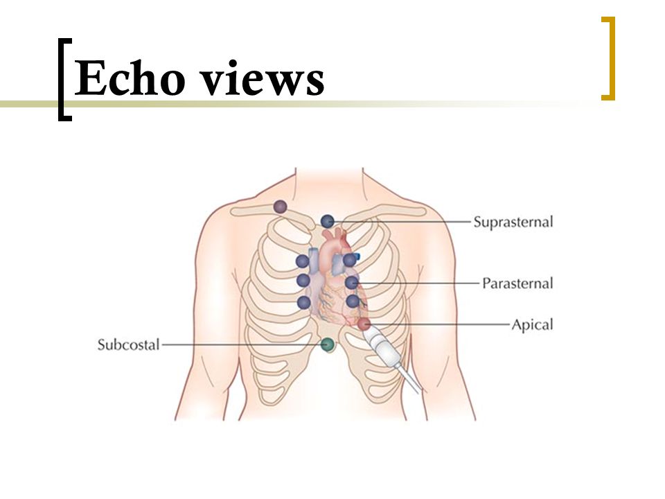 Echo views