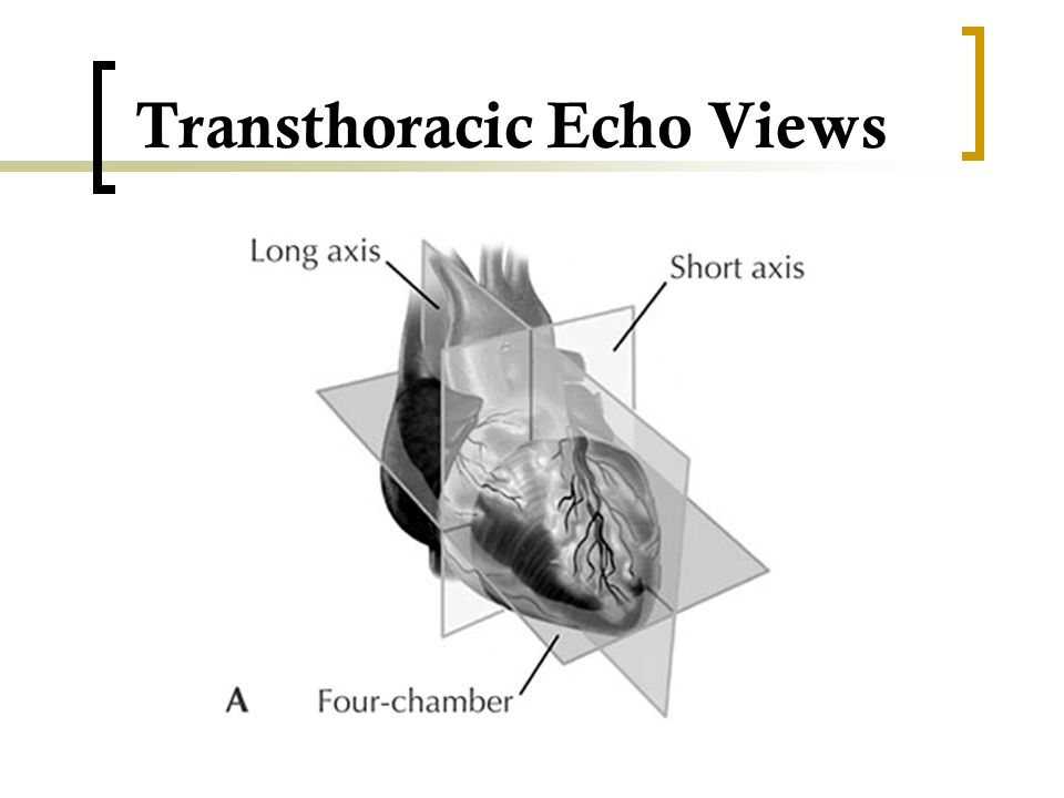 Transthoracic Echo Views