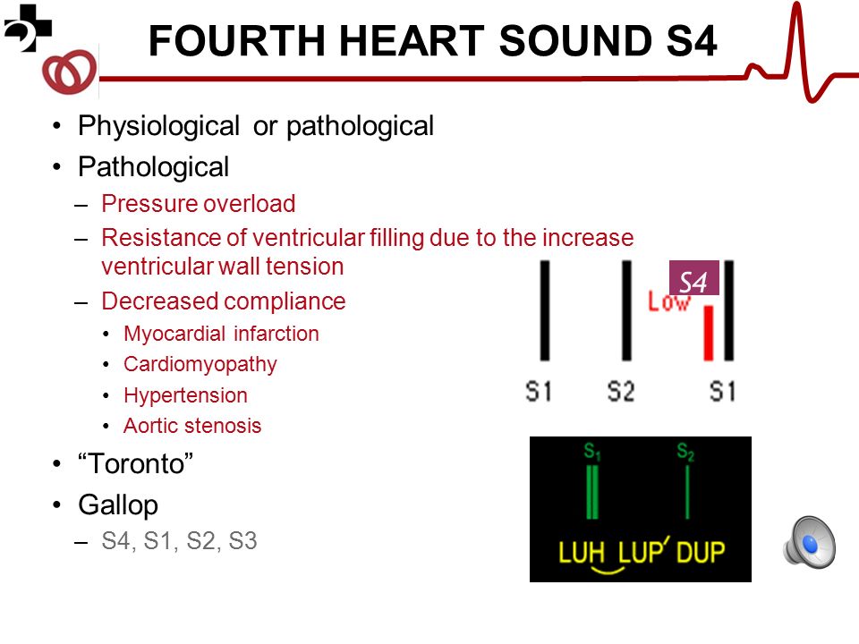 Very visible heartbeat sound pictures