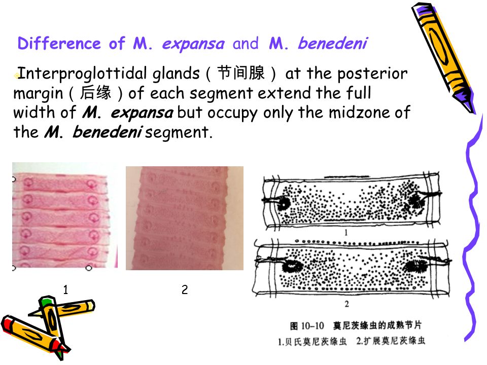 莫尼茨绦虫 主讲:谭韵贤 ppt制作:林冰媛 查找资料:王荷风,王思,刘晨