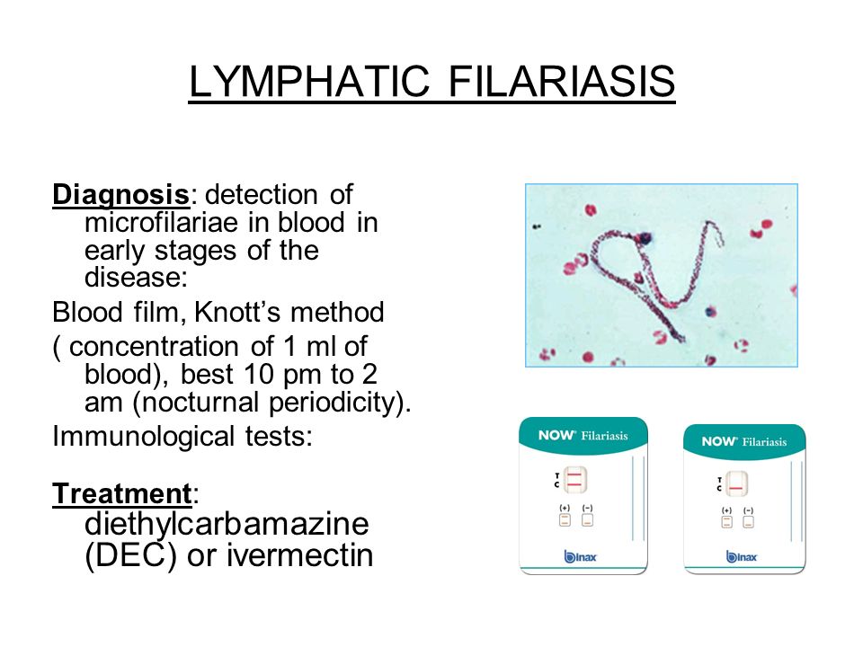 LYMPHATIC FILARIASIS Diagnosis: detection of microfilariae in blood in early stages of the disease: