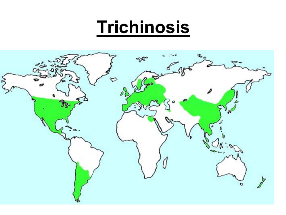Trichinosis