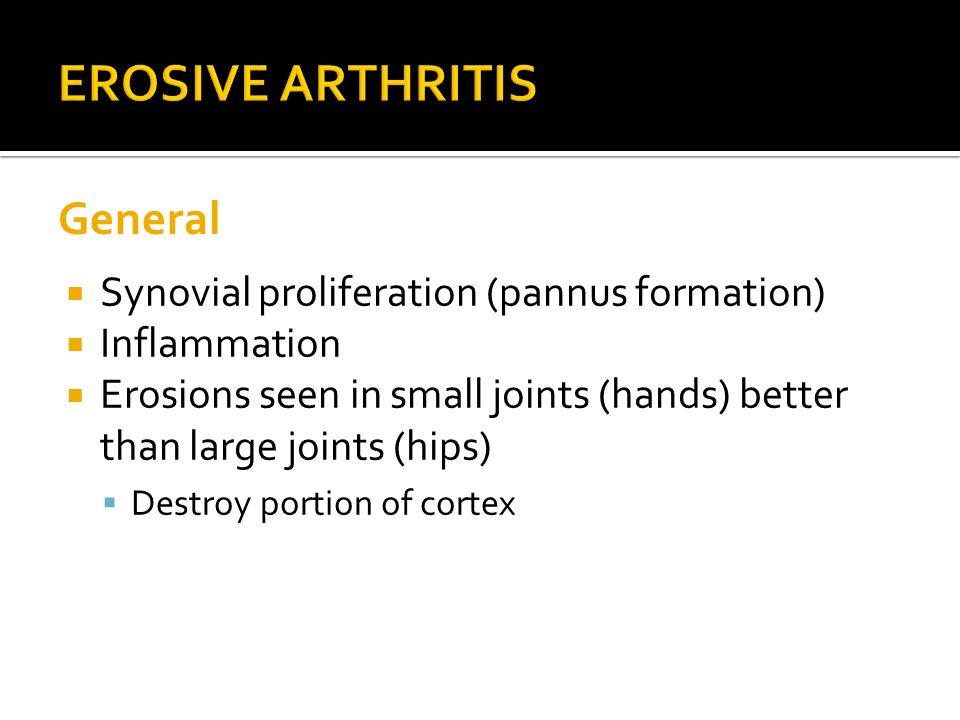 EROSIVE ARTHRITIS General Synovial proliferation (pannus formation)