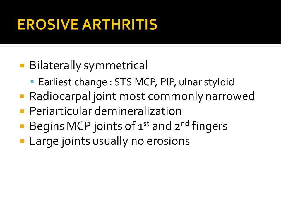 EROSIVE ARTHRITIS Bilaterally symmetrical