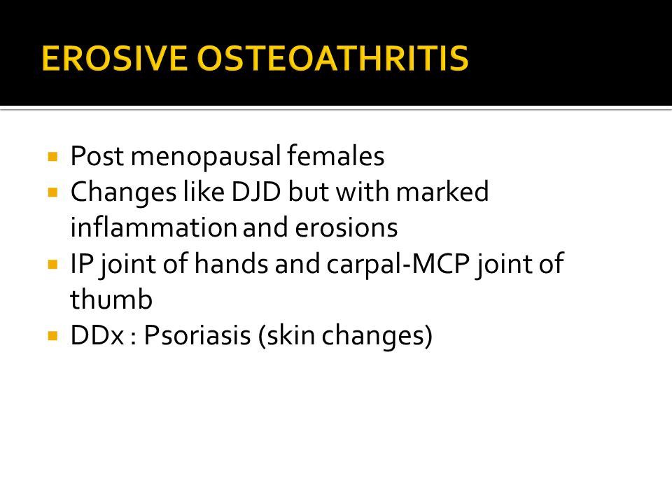 EROSIVE OSTEOATHRITIS