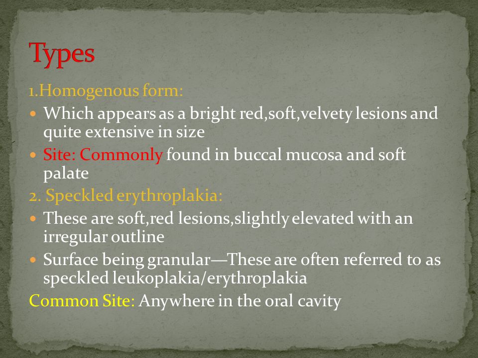 Types 1.Homogenous form: