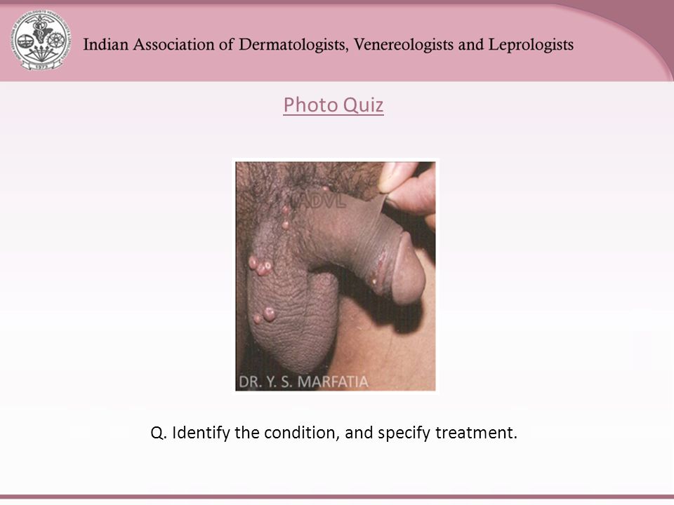 Q. Identify the condition, and specify treatment.