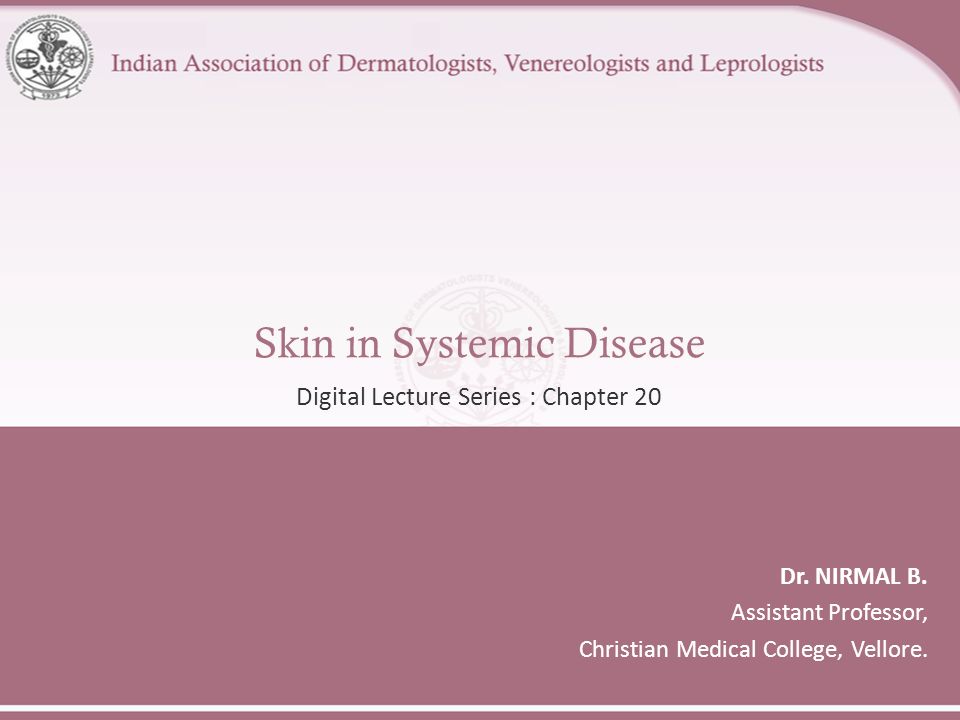 Skin in Systemic Disease -  ppt video online download