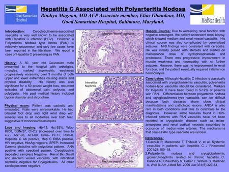 Hepatitis C Associated with Polyarteritis Nodosa Bindiya Magoon, MD ACP Associate member, Elias Ghandour, MD, Good Samaritan Hospital, Baltimore, Maryland.