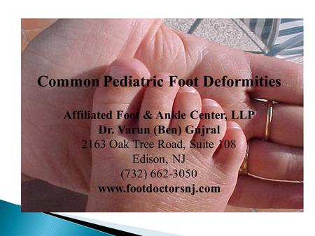 Common Pediatric Foot Deformities Affiliated Foot & Ankle Center, LLP
