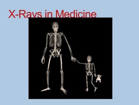 X-Rays in Medicine.