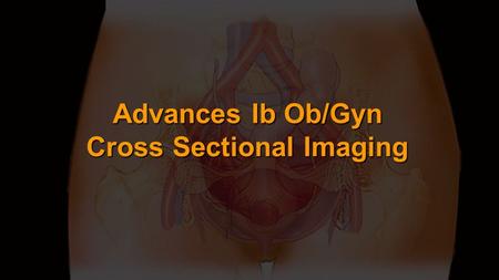Advances Ib Ob/Gyn Cross Sectional Imaging