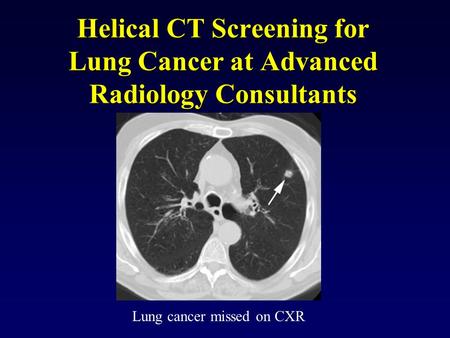 Helical CT Screening for Lung Cancer at Advanced Radiology Consultants