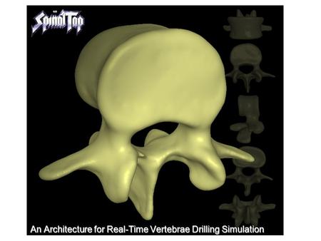 An Architecture for Real-Time Vertebrae Drilling Simulation.