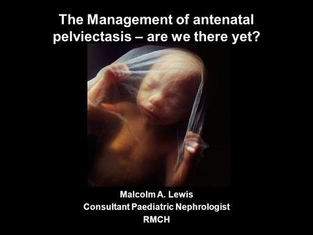 The Management of antenatal pelviectasis – are we there yet? Malcolm A. Lewis Consultant Paediatric Nephrologist RMCH.