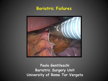 Bariatric Failures Paolo Gentileschi Bariatric Surgery Unit University of Rome Tor Vergata.