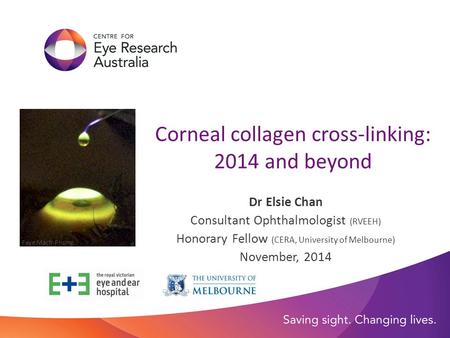 Corneal collagen cross-linking: 2014 and beyond