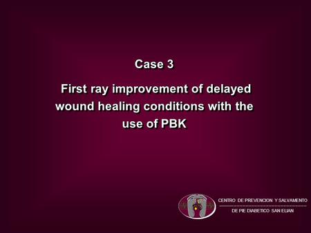 Case 3 First ray improvement of delayed wound healing conditions with the use of PBK First ray improvement of delayed wound healing conditions with the.