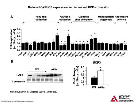 Reduced OXPHOS expression and increased UCP expression.