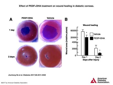 Effect of PEDF+DHA treatment on wound healing in diabetic corneas.