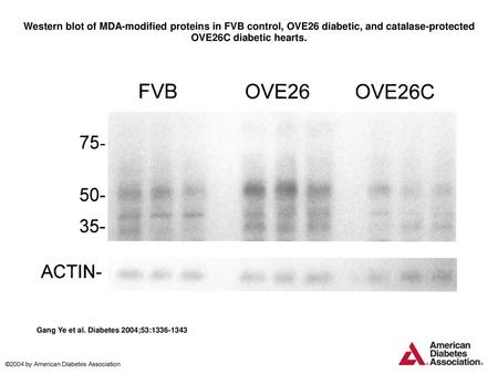 Western blot of MDA-modified proteins in FVB control, OVE26 diabetic, and catalase-protected OVE26C diabetic hearts. Western blot of MDA-modified proteins.