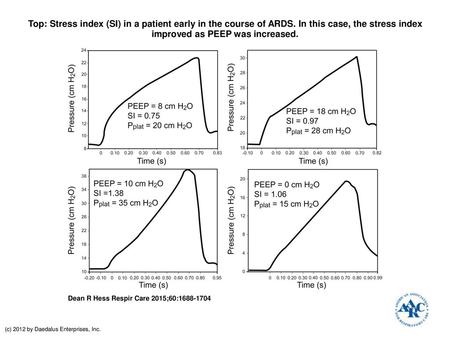 Top: Stress index (SI) in a patient early in the course of ARDS