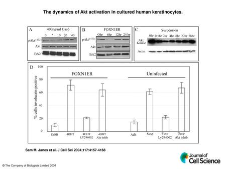 The dynamics of Akt activation in cultured human keratinocytes.