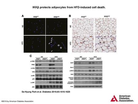 IKKβ protects adipocytes from HFD-induced cell death.
