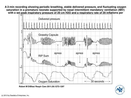 A 2-min recording showing periodic breathing, stable delivered pressure, and fluctuating oxygen saturation in a premature neonate supported by nasal intermittent.