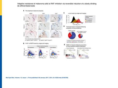 Adaptive resistance of melanoma cells to RAF inhibition via reversible induction of a slowly dividing de‐differentiated state Immunohistochemical analysis.