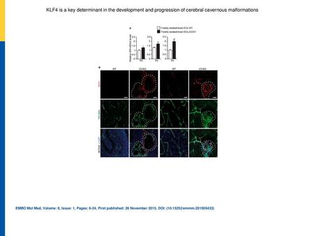 KLF4 is a key determinant in the development and progression of cerebral cavernous malformations qRT–PCR analysis of Klf4 during disease progression at.