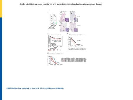 Apelin inhibition prevents resistance and metastasis associated with anti‐angiogenic therapy Number of metastatic lung foci in untreated (control) and.