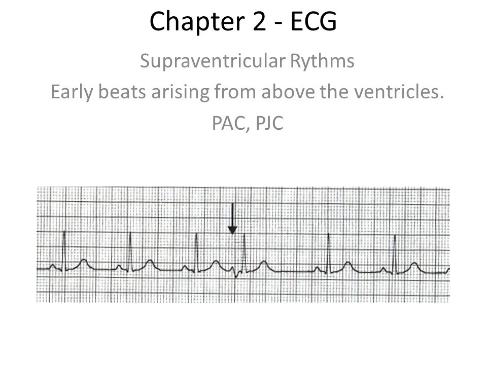 PJC