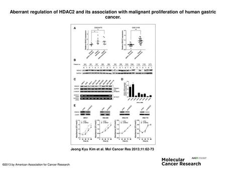 Aberrant regulation of HDAC2 and its association with malignant proliferation of human gastric cancer. Aberrant regulation of HDAC2 and its association.