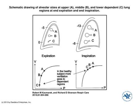 Schematic drawing of alveolar sizes at upper (A), middle (B), and lower dependent (C) lung regions at end expiration and end inspiration. Schematic drawing.