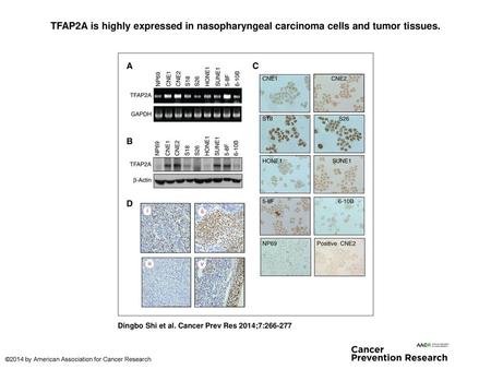 TFAP2A is highly expressed in nasopharyngeal carcinoma cells and tumor tissues. TFAP2A is highly expressed in nasopharyngeal carcinoma cells and tumor.