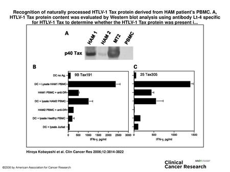 Recognition of naturally processed HTLV-1 Tax protein derived from HAM patient's PBMC. A, HTLV-1 Tax protein content was evaluated by Western blot analysis.