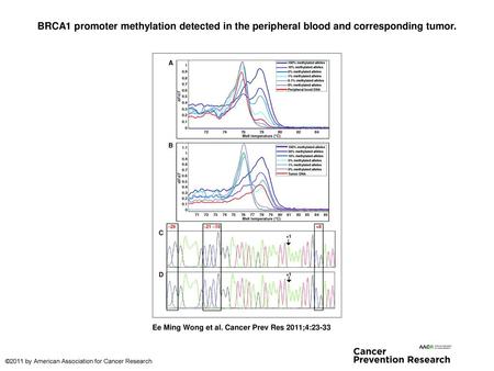 BRCA1 promoter methylation detected in the peripheral blood and corresponding tumor. BRCA1 promoter methylation detected in the peripheral blood and corresponding.