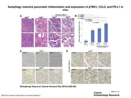 Autophagy restrains pancreatic inflammation and expression of pTBK1, CCL5, and PD-L1 in vivo. Autophagy restrains pancreatic inflammation and expression.