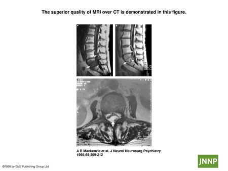 The superior quality of MRI over CT is demonstrated in this figure.