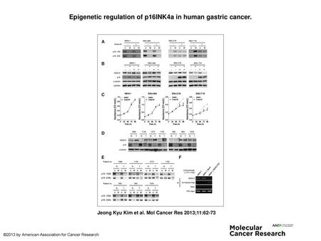 Epigenetic regulation of p16INK4a in human gastric cancer.