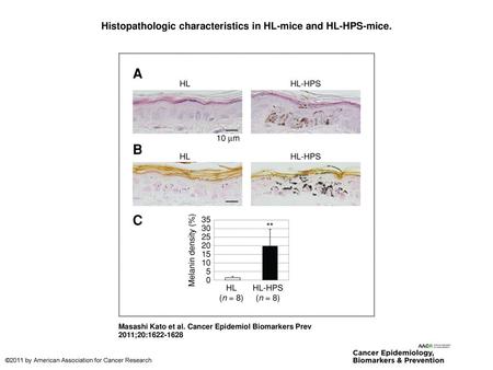 Histopathologic characteristics in HL-mice and HL-HPS-mice.