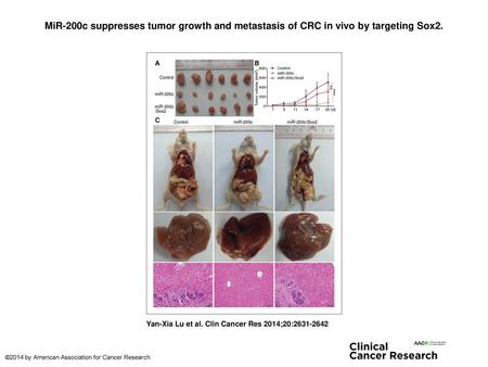 MiR-200c suppresses tumor growth and metastasis of CRC in vivo by targeting Sox2. MiR-200c suppresses tumor growth and metastasis of CRC in vivo by targeting.