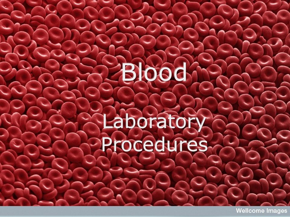 Hematology Defined: The study of blood Why is hematology important?  Evaluation of disease states Screening for well animals as a baseline  Pre-anesthetic. - ppt download
