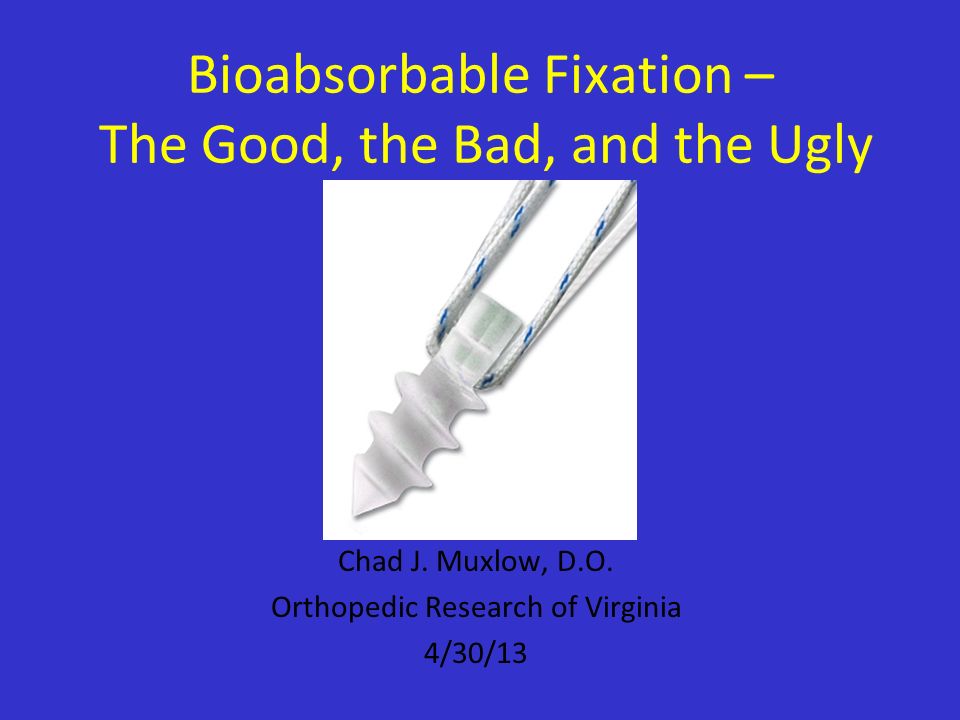 Bioabsorbable Fixation – The Good, the Bad, and the Ugly - ppt video online  download