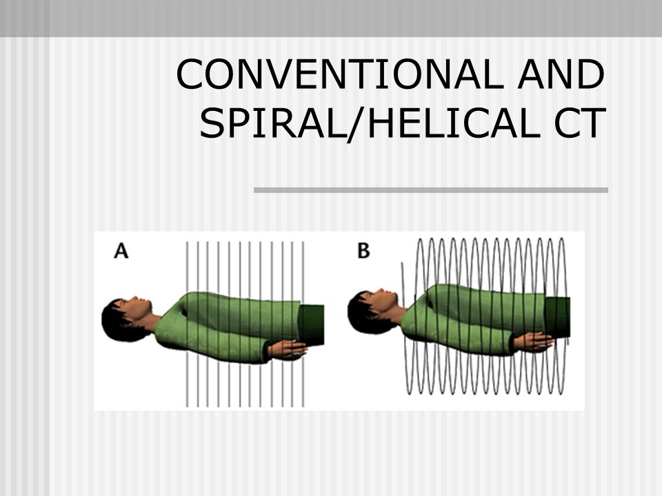 CONVENTIONAL AND SPIRAL/HELICAL CT - ppt video online download