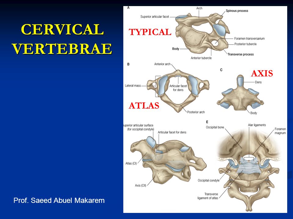 cervical vertebrae labeled axis