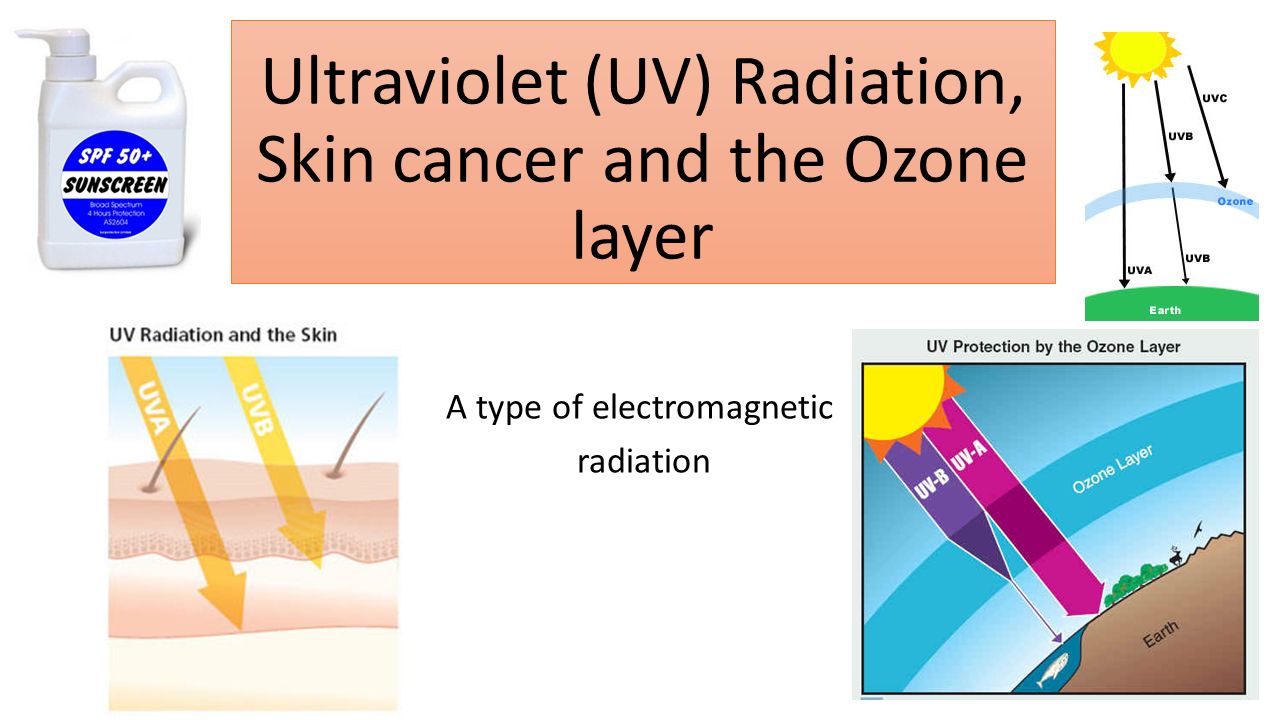 Ultraviolet (UV) Radiation, Skin cancer and the Ozone layer A type of  electromagnetic radiation. - ppt download