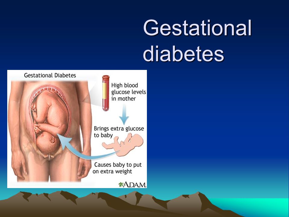 gestational diabetes ppt