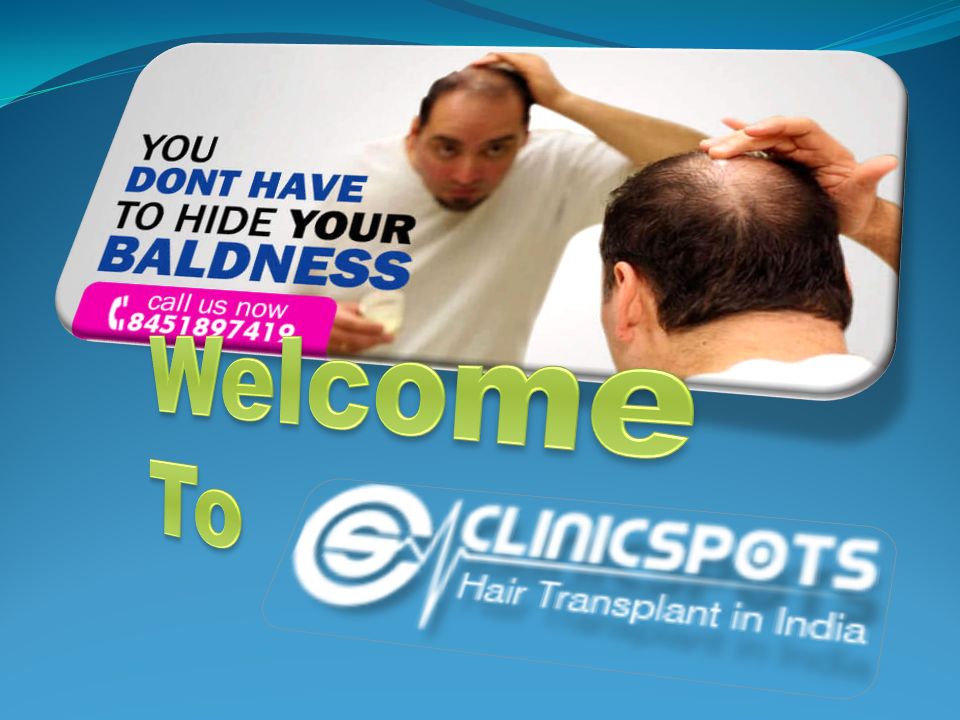 Men, by nature, are careless about their face and weight. When it comes to  their hairline, baldness is one of their biggest horrors. Baldness is a  very. - ppt download